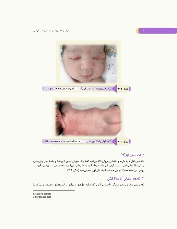 مراقبت‌های روتین نوزادان و شیرخواران کلینیک نوزادان در منزل شما