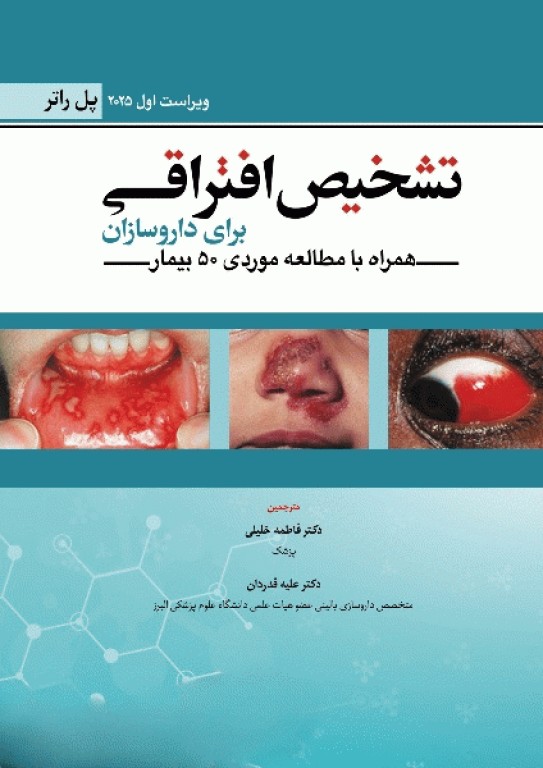 تشخیص افتراقی برای داروسازان پل راتر 2025