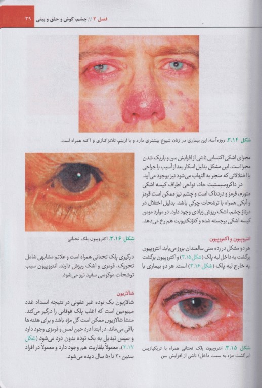 تشخیص افتراقی برای داروسازان پل راتر 2025