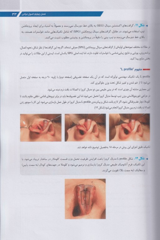 تئورینوپلاستی