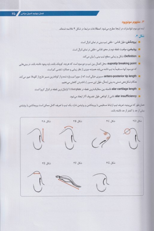 تئورینوپلاستی