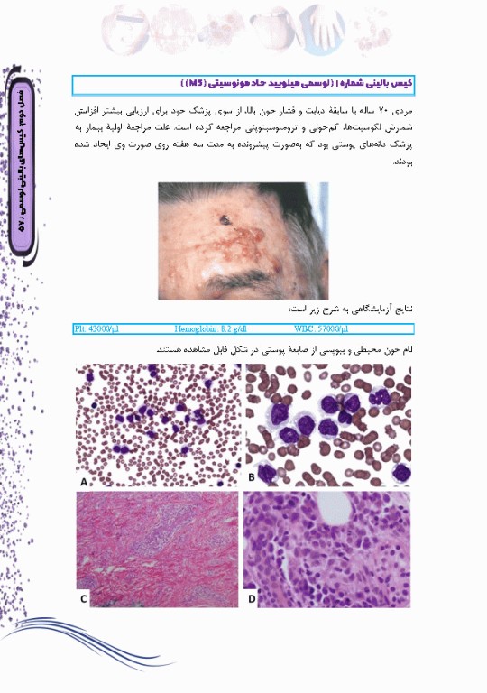 کیس‌های بالینی هماتولوژی و ایمونوهماتولوژی از تشخیص آزمایشگاهی تا رویکرد به درمان بیماری