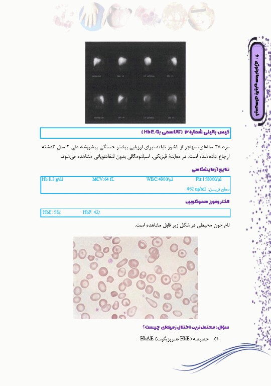 کیس‌های بالینی هماتولوژی و ایمونوهماتولوژی از تشخیص آزمایشگاهی تا رویکرد به درمان بیماری