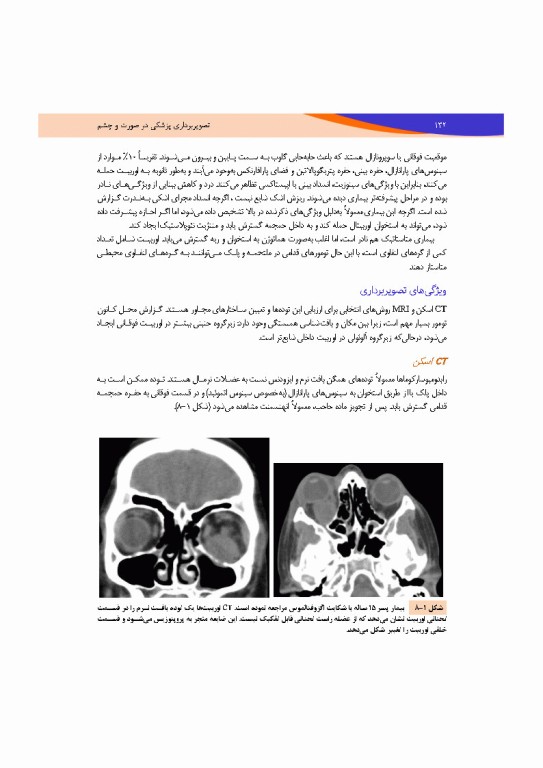 تصویربرداری پزشکی صورت و چشم