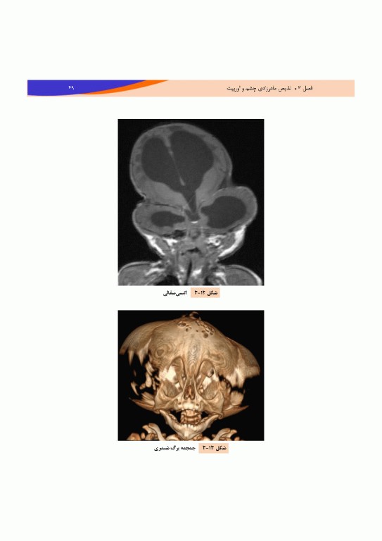 تصویربرداری پزشکی صورت و چشم