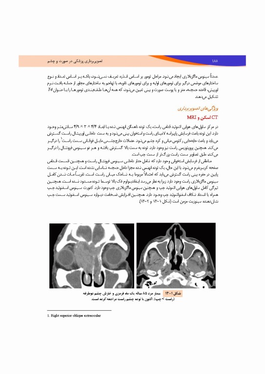 تصویربرداری پزشکی صورت و چشم