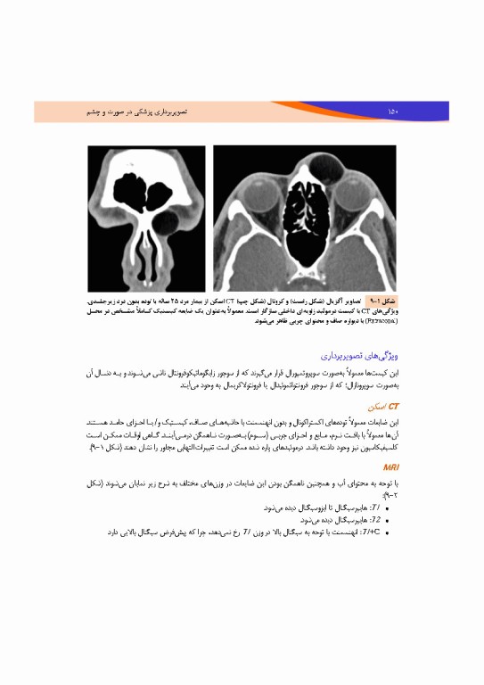 تصویربرداری پزشکی صورت و چشم