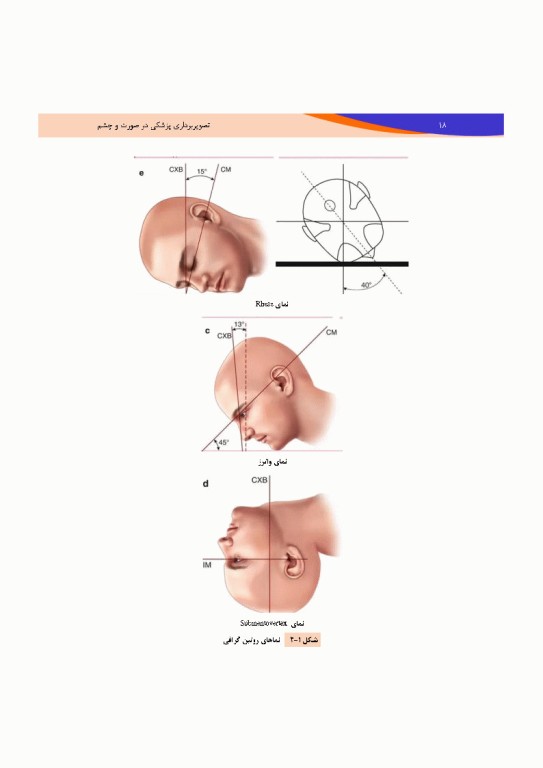 تصویربرداری پزشکی صورت و چشم