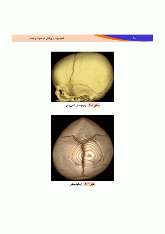 تصویربرداری پزشکی صورت و چشم