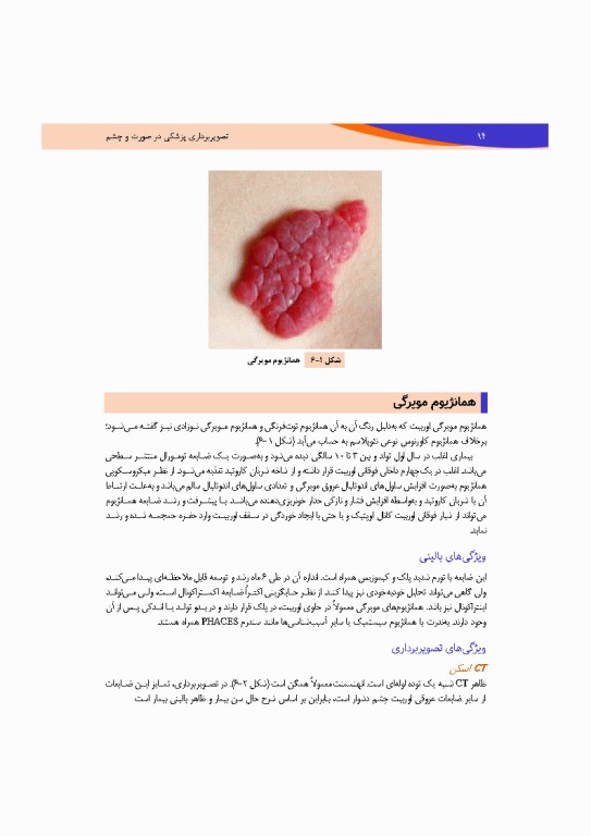 تصویربرداری پزشکی صورت و چشم