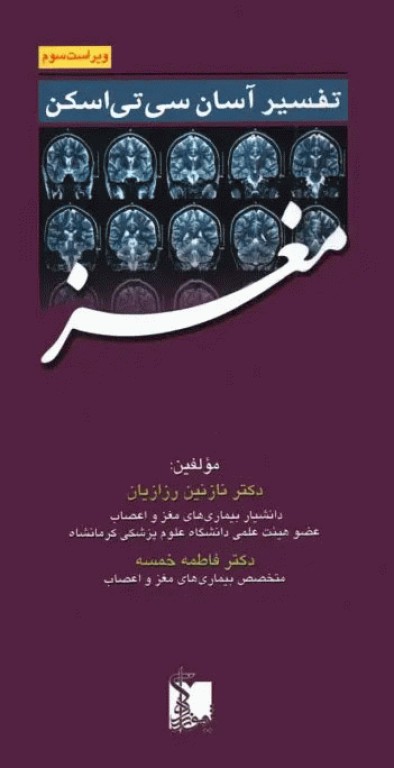 تفسیر آسان سی‌ تی اسکن مغز