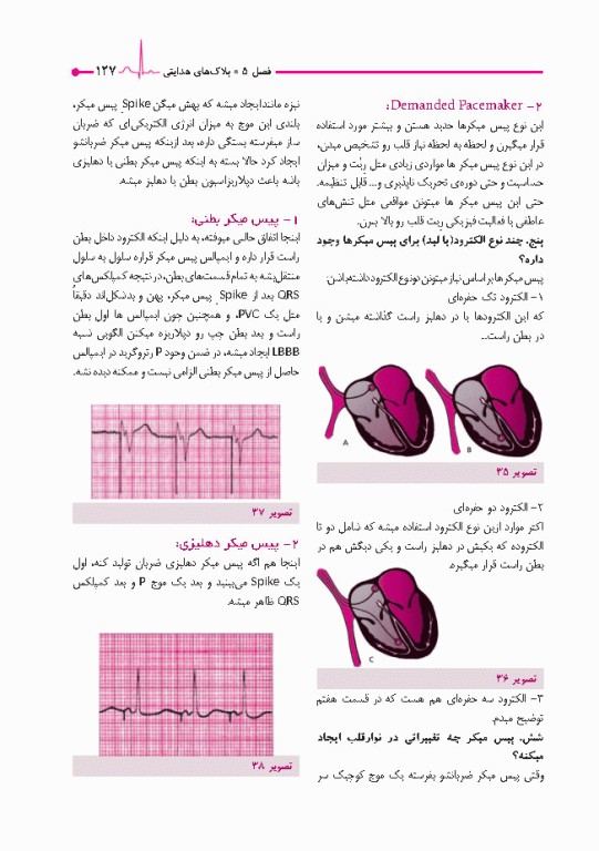 صفر تا صد تفسیر نوار قلب EKG به زبان ساده و خودمانی