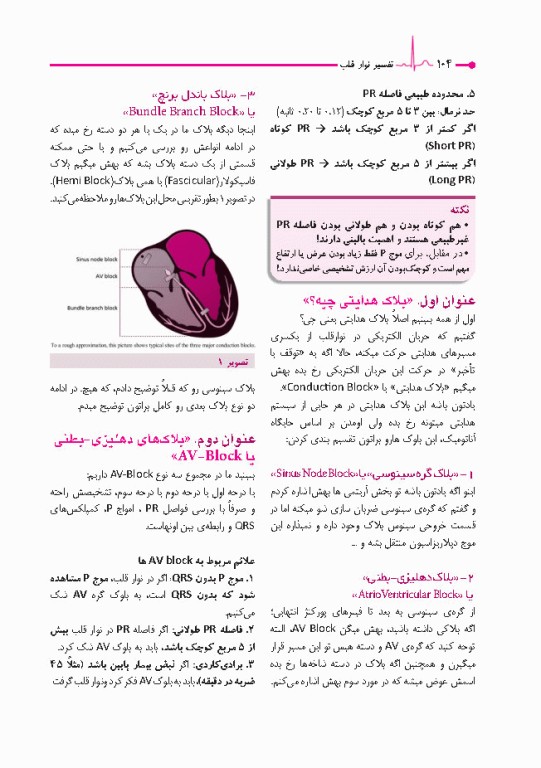 صفر تا صد تفسیر نوار قلب EKG به زبان ساده و خودمانی