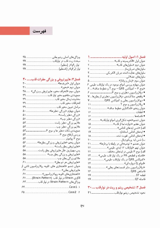 صفر تا صد تفسیر نوار قلب EKG به زبان ساده و خودمانی