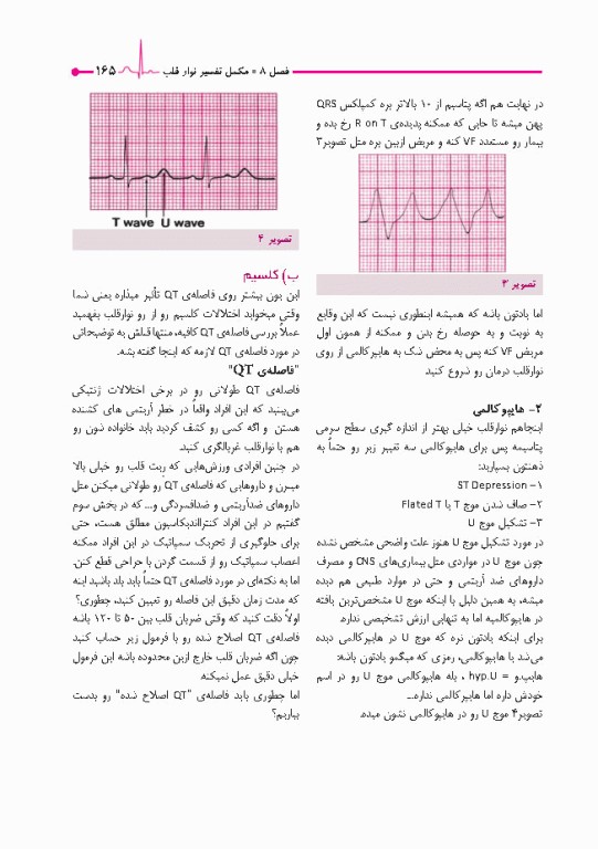صفر تا صد تفسیر نوار قلب EKG به زبان ساده و خودمانی