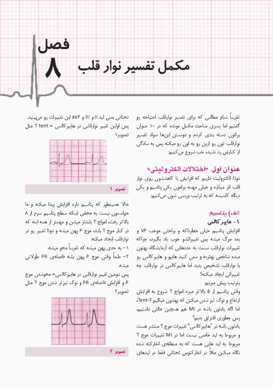 صفر تا صد تفسیر نوار قلب EKG به زبان ساده و خودمانی