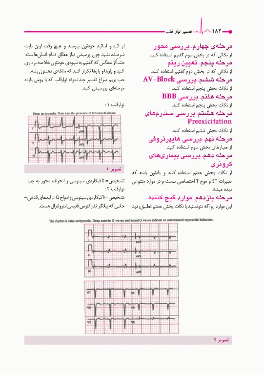 صفر تا صد تفسیر نوار قلب EKG به زبان ساده و خودمانی