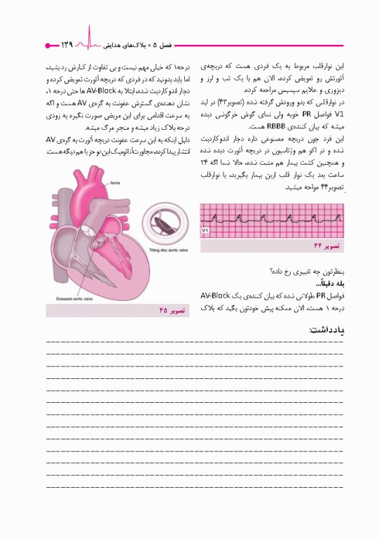صفر تا صد تفسیر نوار قلب EKG به زبان ساده و خودمانی