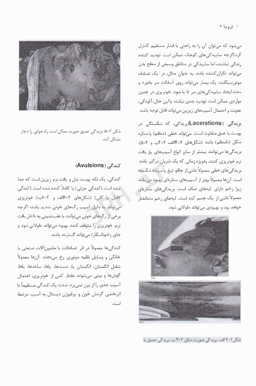 تروما 2023 جلد دوم ترجمه دکتر گودرزی