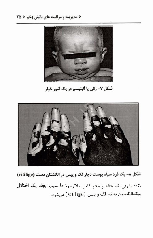 آن سوی پوست، مدیریت و مراقبت‌های بالینی زخم