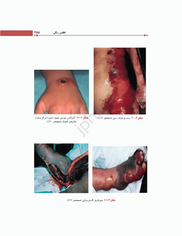 میکروب‌شناسی برای دانشجویان پرستاری، مامایی و اتاق عمل ویراست دوم