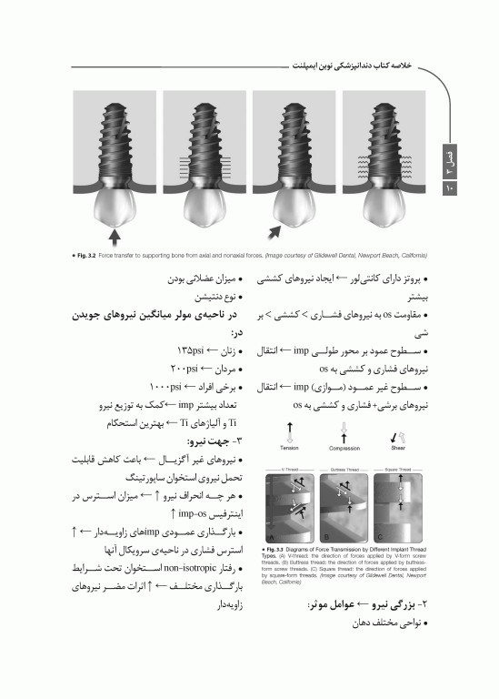 خلاصه کتاب Book Brief دندانپزشکی نوین ایمپلنت میش 2021