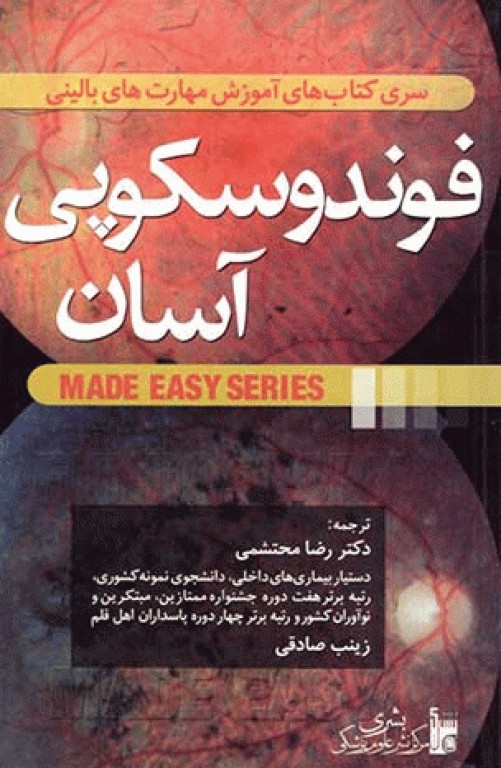 فوندوسکوپی آسان دکتر محتشمی