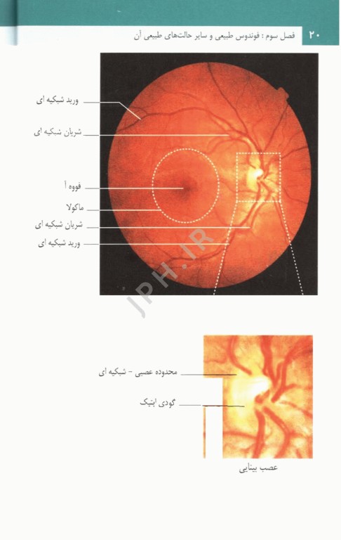 فوندوسکوپی آسان دکتر محتشمی