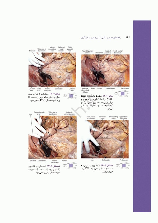 راهنمای مصور و بالینی تشریح بدن انسان گری 2025