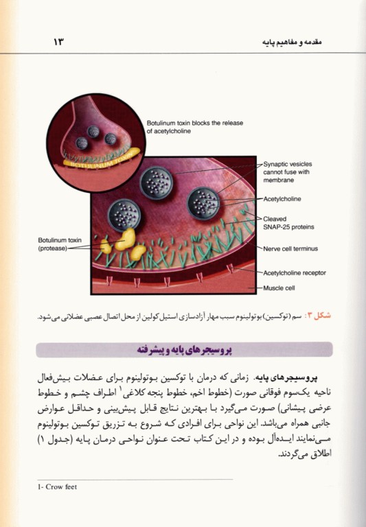 راهنمای کاربردی تزریق توکسین بوتولینوم دکتر رمزی