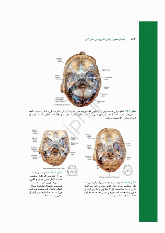 راهنمای مصور و بالینی تشریح بدن انسان گری 2025
