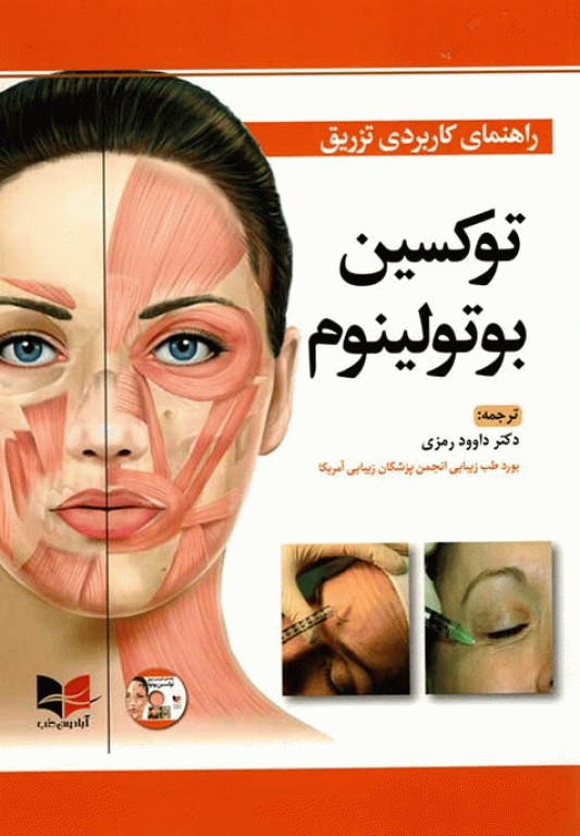 راهنمای کاربردی تزریق توکسین بوتولینوم دکتر رمزی