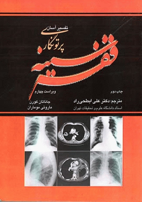تفسیر آسان پرتونگاری قفسه سینه ویراست چهارم