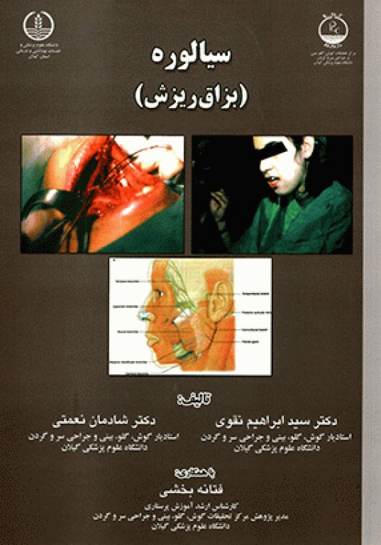 سیالوره (بزاق ریزش)