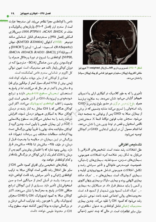 اصول طب کودکان نلسون 2025 بیماری‌های غدد