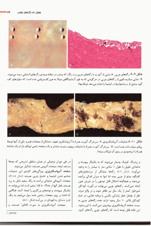 آسیب‌شناسی پایه اختصاصی رابینز 2023 ترجمه دکتر شکور