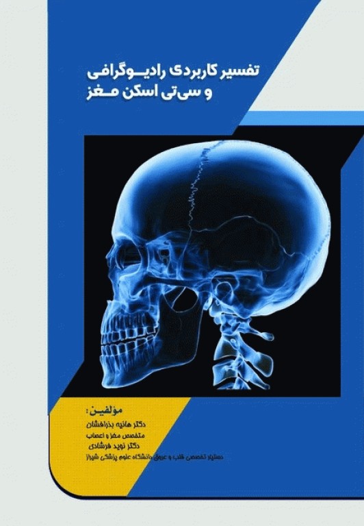 تفسیر کاربردی رادیوگرافی و سی تی اسکن مغز