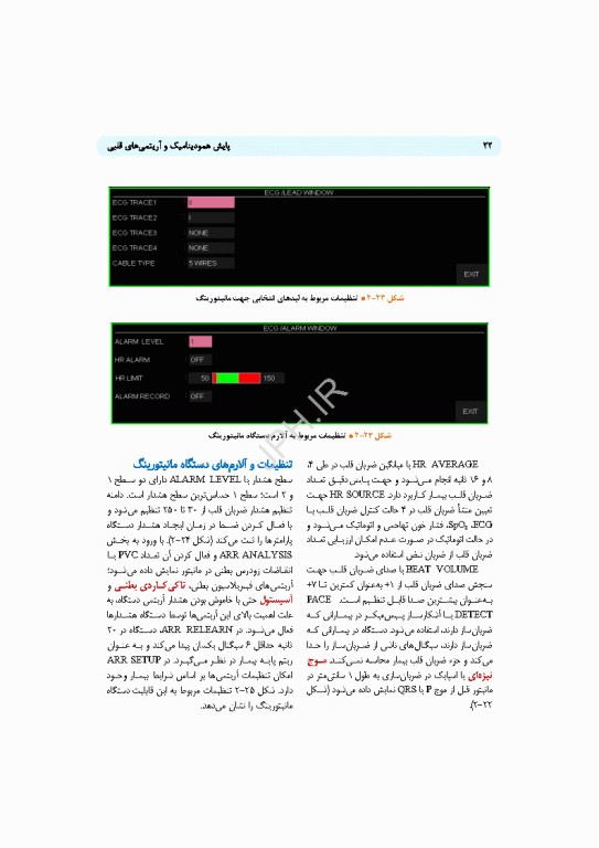 پایش همودینامیک و آریتمی‌های قلبی