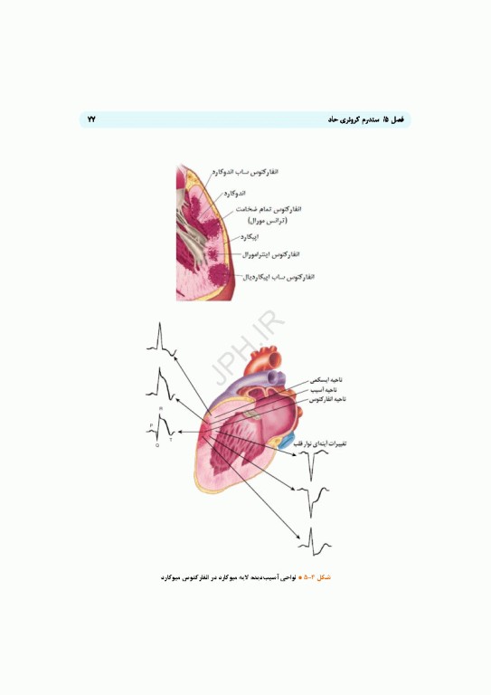 پایش همودینامیک و آریتمی‌های قلبی