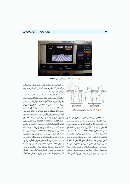 پایش همودینامیک و آریتمی‌های قلبی