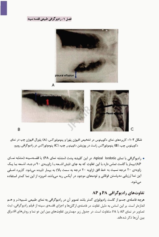 تفسیر کاربردی رادیوگرافی و سی تی اسکن قفسه سینه