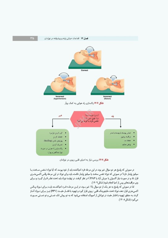 مدیریت احیای قلبی ریوی رویکردی گام به گام در مسیر مراقبت از احیا تا مرگ مغزی