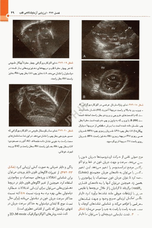 طب کودکان نلسون 2025 بیماری‌های قلب و عروق