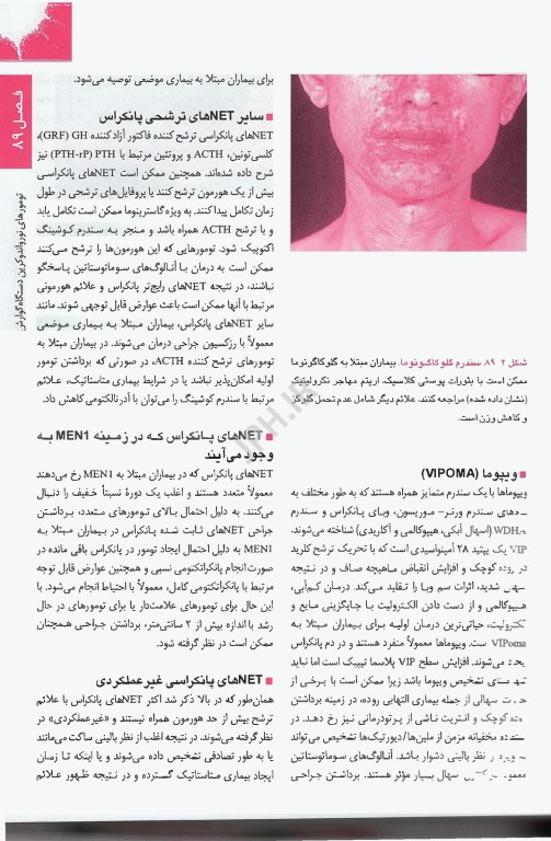 اصول طب داخلی هاریسون 2025 غدد و متابولیسم
