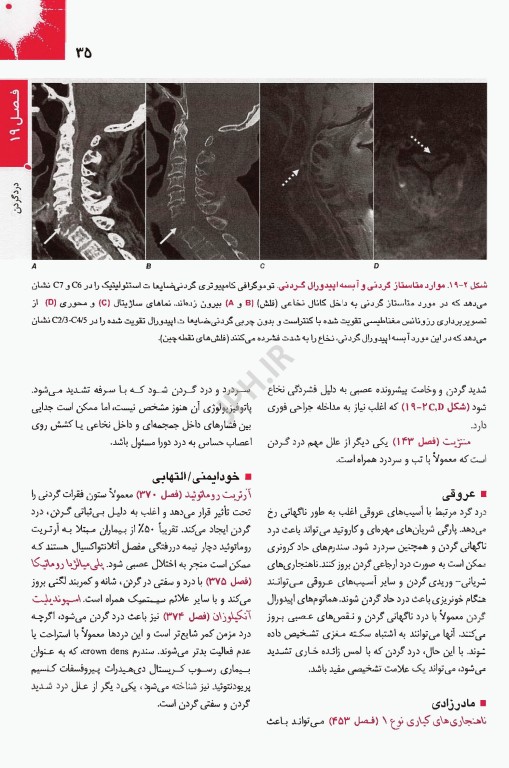 اصول طب داخلی هاریسون 2025 روماتولوژی