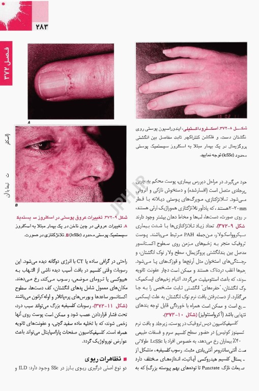 اصول طب داخلی هاریسون 2025 روماتولوژی