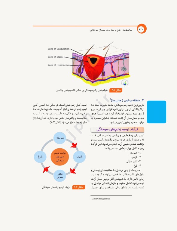 مراقبت‌های جامع پرستاری در بیماران سوختگی از اورژانس تا بازتوانی