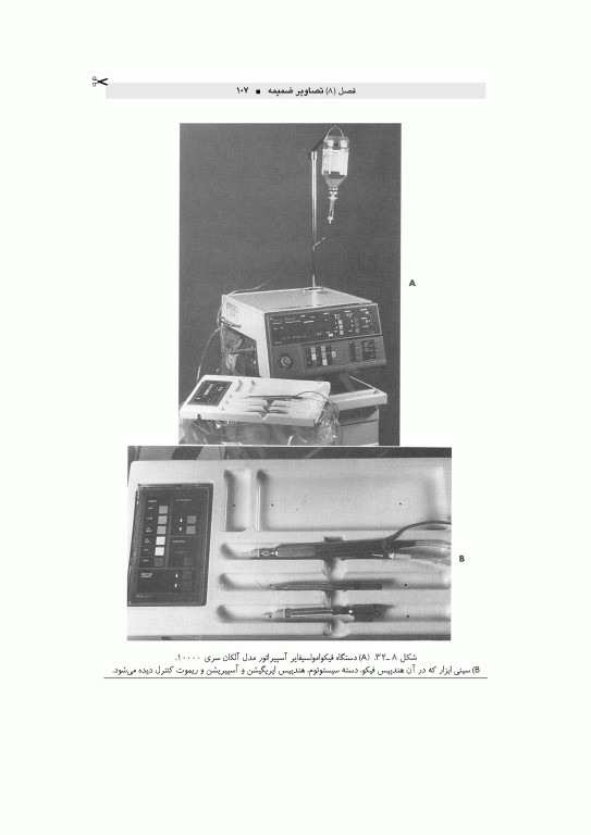 تکنولوژی جراحی چشم اعرابی و خدادادی