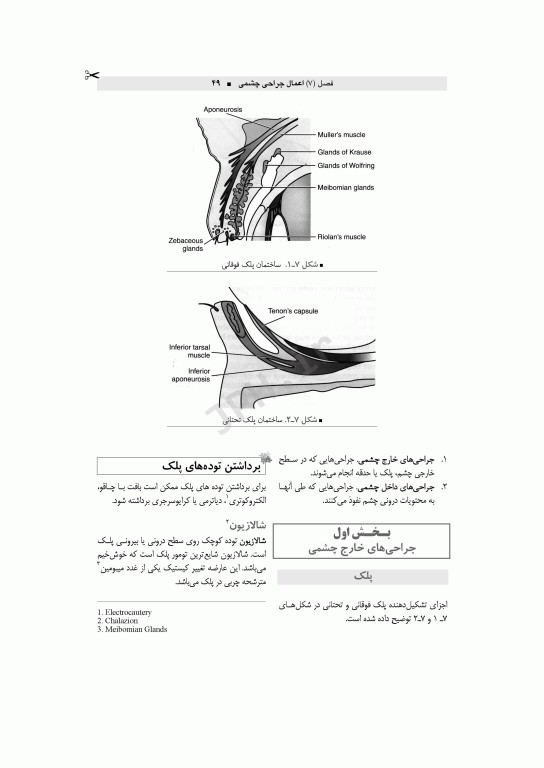تکنولوژی جراحی چشم اعرابی و خدادادی