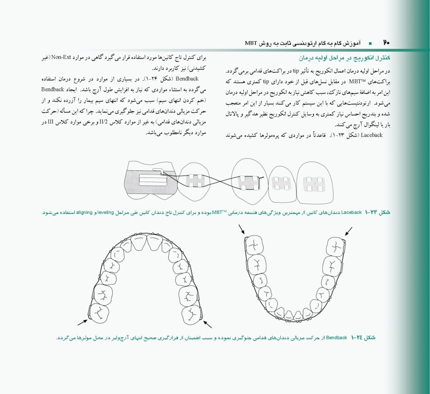 اصول و مبانی ارتودنسی ثابت به روش MBT دکتر حمید قنبری